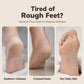 🥳HOT SALE🥳💞10K+ SOLD! Foot Remover ! 3-in-1, nano glass & dual speed. Soft, smooth feet – grab yours! ✅